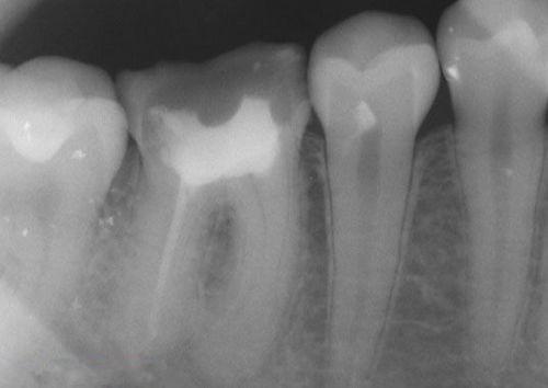 中國(guó)再生牙齒研究新進(jìn)展，重塑微笑，科技引領(lǐng)牙齒再生新篇章