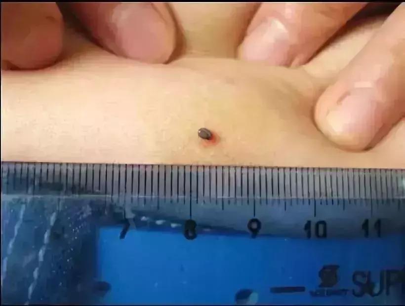 小明快樂疫情日志，最新疫情發(fā)布與日常觀察